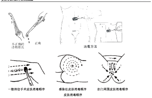 臨床助理醫(yī)師技能基本操作