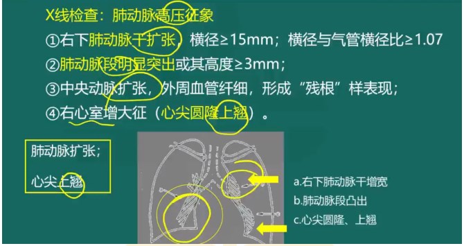 慢性肺源性心臟病X線檢查